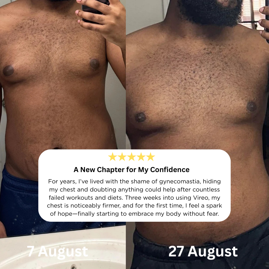 No More Man Boobs – Get a Flat, Firm Chest in Weeks with Vireo